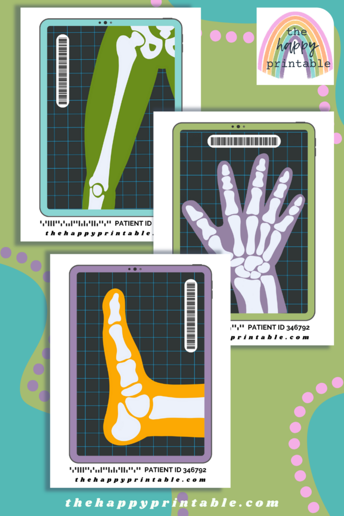 These free printable x rays are the perfect addition to playing doctor, learning anatomy, or role playing!