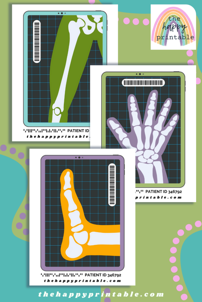 Printable Pretend X-Rays | The Happy Printable