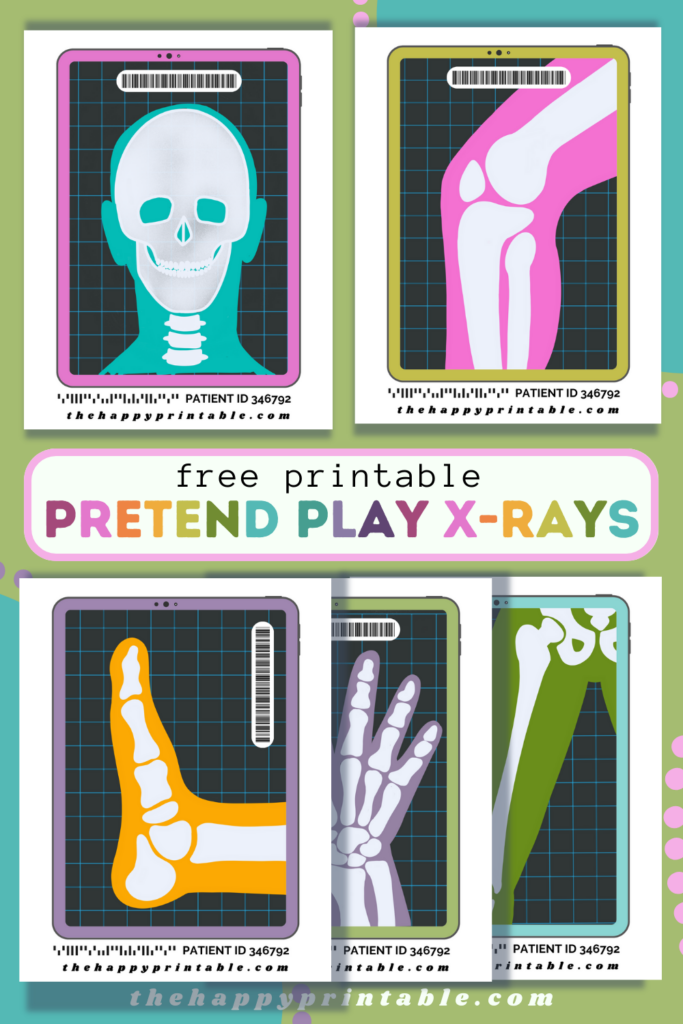 These free printable x rays are the perfect addition to playing doctor, learning anatomy, or role playing!