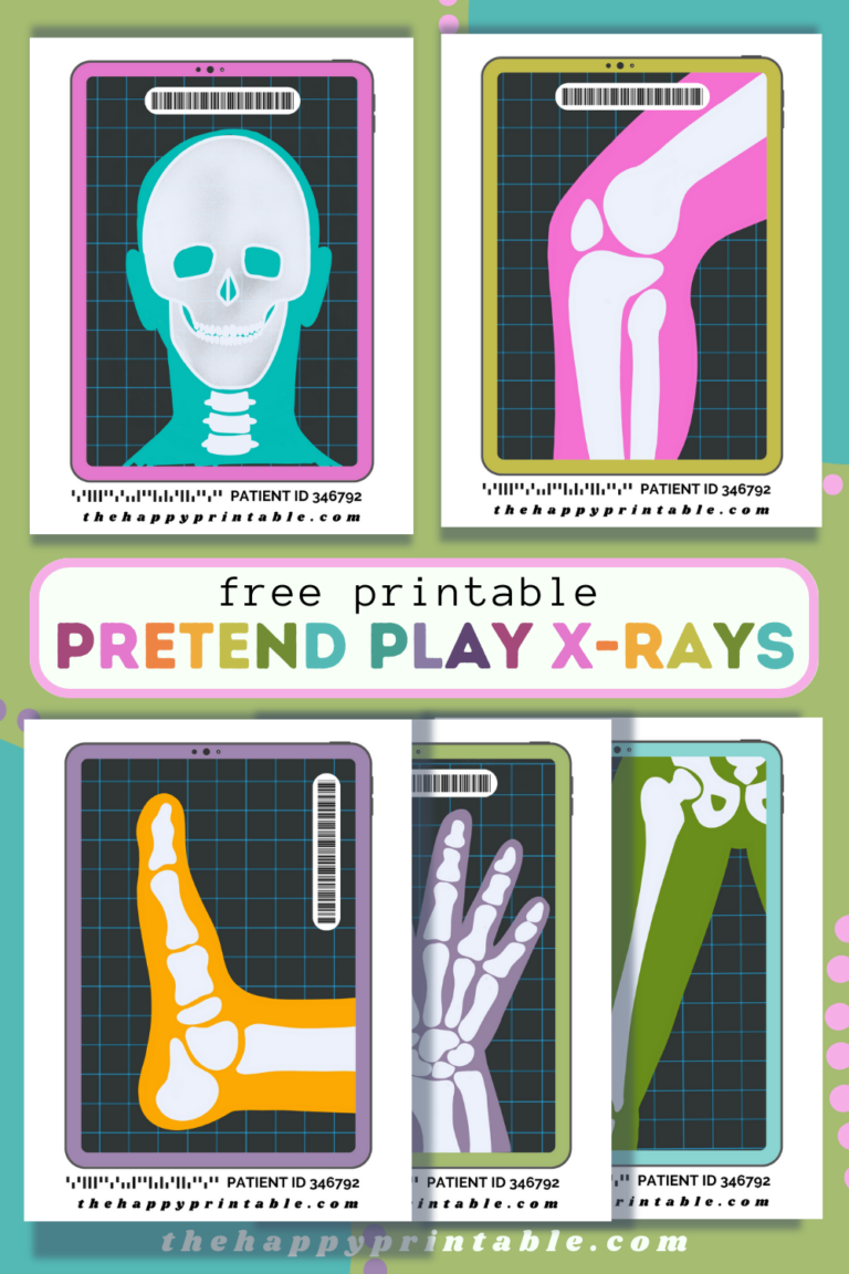 Printable Pretend X-Rays | The Happy Printable