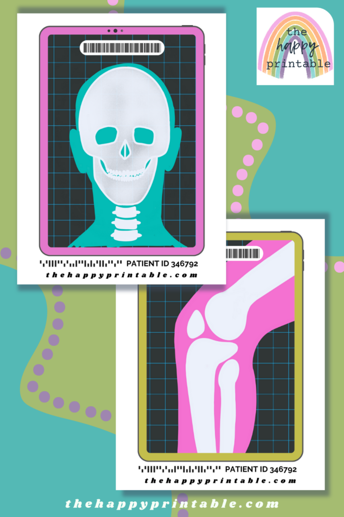 These free printable x rays are the perfect addition to playing doctor, learning anatomy, or role playing!