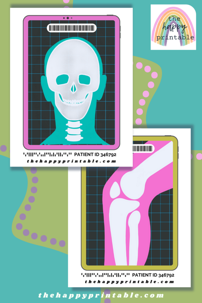 Printable Pretend X-Rays | The Happy Printable